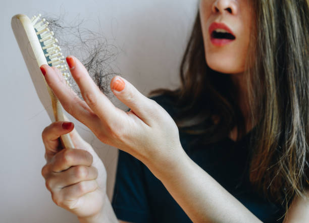 chute de cheveux