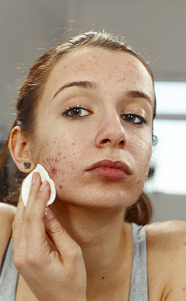 Avène
